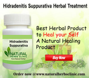 Natural Remedies for Hidradenitis Suppurativa Reduce Growth of More ...