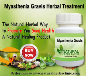 Natural Remedies of Myasthenia Gravis Relieve the Symptoms - Natural ...