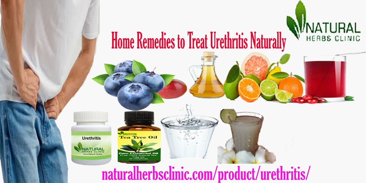 Home Remedies to Treat Urethritis Naturally