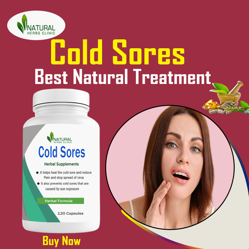 natural-remedies-for-cold-sores-to-reduce-duration-and-time