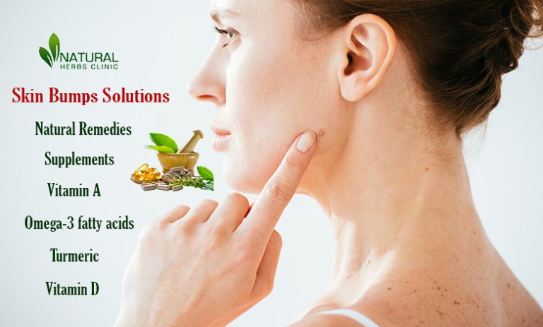 Skin Bumps Problem The Trendy Solutions You Need To Try 3074