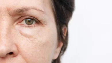 How to get rid of eye bags, according to dermatologists