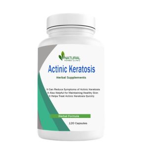 Herbal-Supplements-fo-Actinic-Keratosis-768x768