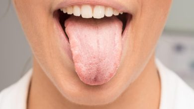 Lichen Planus Mouth Treatment Innovative Solutions for Quick Relief