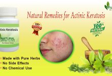 Home-Remedies-for-Actinic-Keratosis:-Healing-with-Natural-Treatments