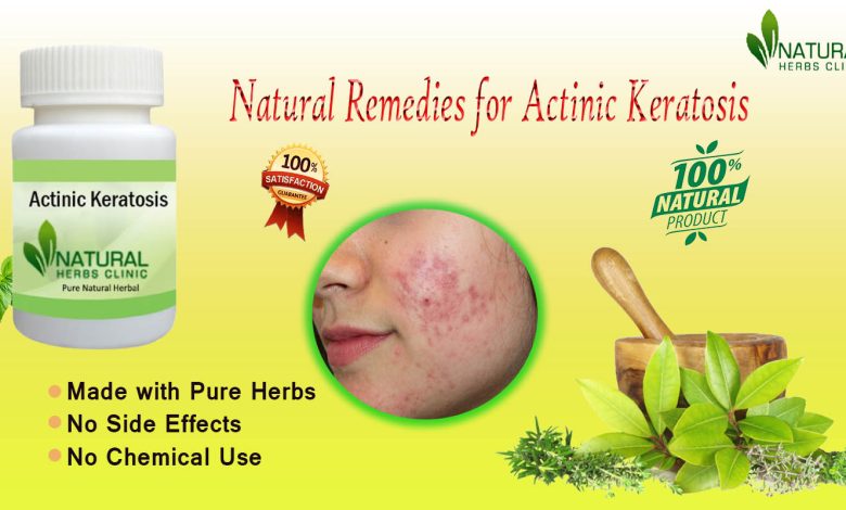 Home-Remedies-for-Actinic-Keratosis:-Healing-with-Natural-Treatments