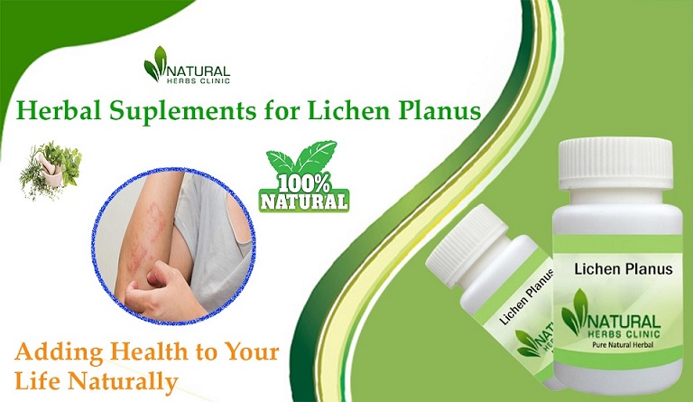 Herbal-Supplements-For-Lichen-Planus