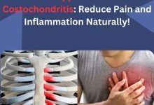 Best Supplements for Costochondritis