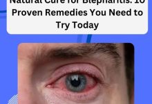 Natural Cure for Blepharitis