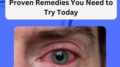 Natural Cure for Blepharitis