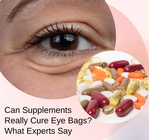 Can Supplements Really Cure Eye Bags